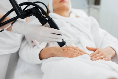 Genç bir kız güzellik salonunda ellerinin derisi için karbon soyuluyor. Lazer darbeleri deriyi temizler. Donanım kozmetolojisi. Fototermoliz süreci, deriyi ısıtır..