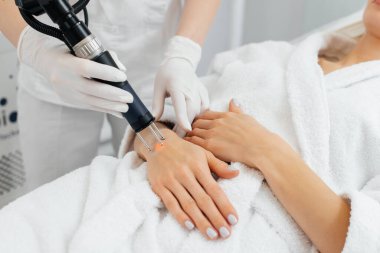 Genç bir kız güzellik salonunda ellerinin derisi için karbon soyuluyor. Lazer darbeleri deriyi temizler. Donanım kozmetolojisi. Fototermoliz süreci, deriyi ısıtır..