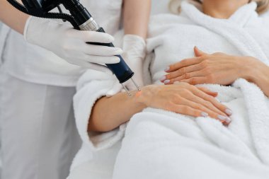 Genç bir kız güzellik salonunda ellerinin derisi için karbon soyuluyor. Lazer darbeleri deriyi temizler. Donanım kozmetolojisi. Fototermoliz süreci, deriyi ısıtır..