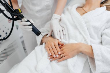 Genç bir kız güzellik salonunda ellerinin derisi için karbon soyuluyor. Lazer darbeleri deriyi temizler. Donanım kozmetolojisi. Fototermoliz süreci, deriyi ısıtır..