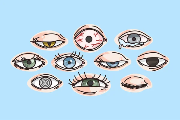 Collection of various eye disease or problems — Stock Vector