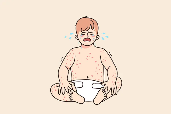 Tangisan bayi yang tidak bahagia menderita penyakit eksim - Stok Vektor