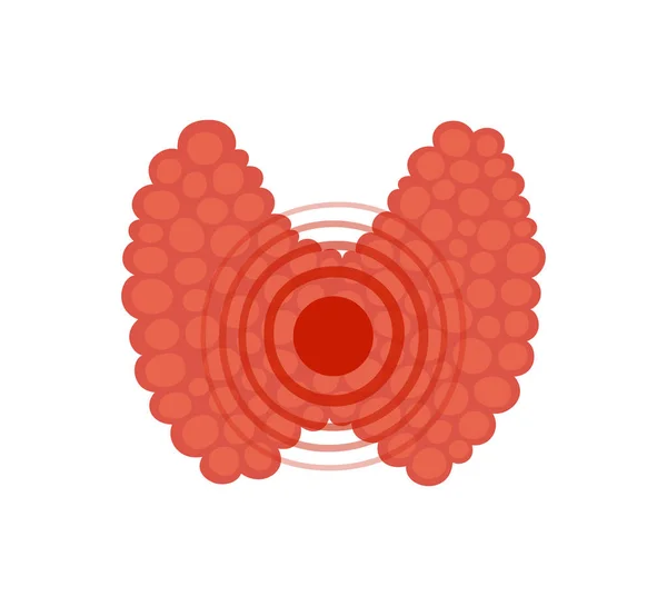 Sköldkörtel och smärtpunkt i platt stil. Ritning av en sjuk sköldkörtel. Hypotyreos och hypertyreoidism koncept. vektor illustration isolerad på vit bakgrund — Stock vektor