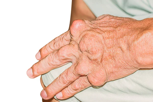 Eklem ağrısı, kemik ağrısı, gut, romatizma semptomları, radyoaktif hastalık, erkek osteoporozu, yaralı kemik, yaralanma, ağrı, eklem iltihabı, kol, diz, diz