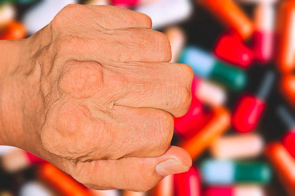 Eklem ağrısı, kemik ağrısı, gut, romatizma semptomları, radyoaktif hastalık, erkek osteoporozu, yaralı kemik, yaralanma, ağrı, eklem iltihabı, kol, diz, diz