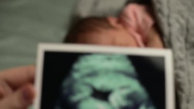 Yeni doğan bebeğe karşı hamilelik ultrason taraması