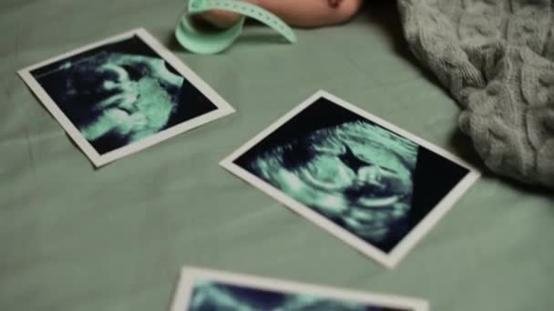 Gülümseyen yeni doğmuş bebek ultrason taramalarının yanında yatıyor. — Stok video