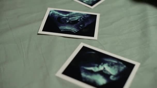 Kamera slide sepanjang gambar USG bayi dan menunjukkan bayi yang baru lahir — Stok Video