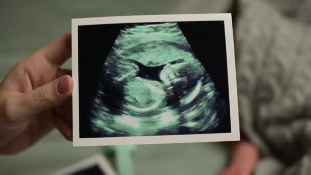 Μια υπερηχητική σάρωση πίσω από την οποία κρύβεται ένα νεογέννητο μωρό. — Αρχείο Βίντεο