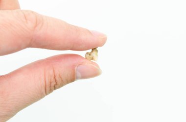 Beyaz bir arka planda, bir kedinin dişi dişçiden düştü.