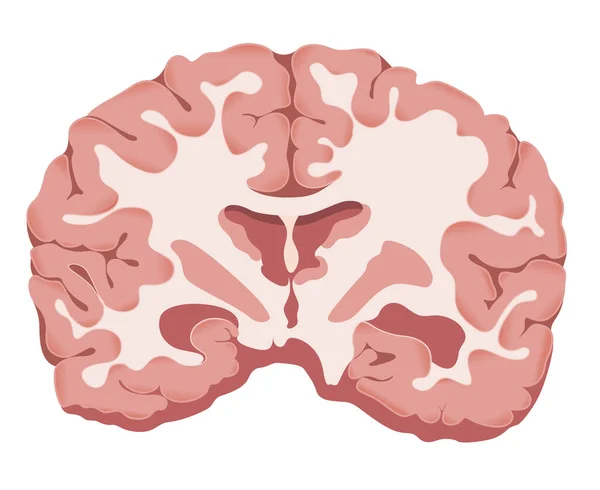 Seção Transversal Cérebro Ilustração Como Arquivo Eps —  Vetores de Stock