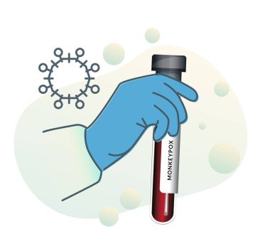 Monkeypox - Testing  - Illustration  as EPS 10 File