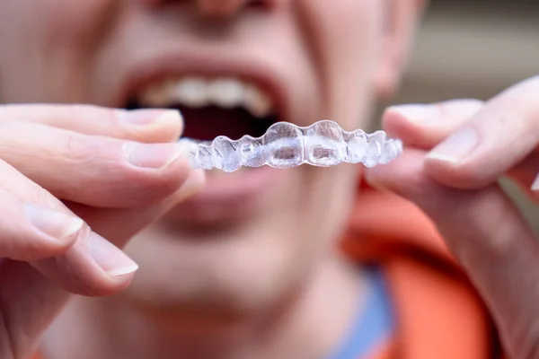Man Holding Put Invisible Braces Orthodontic Dental Braces Teeth Straighteners — Stock Photo, Image