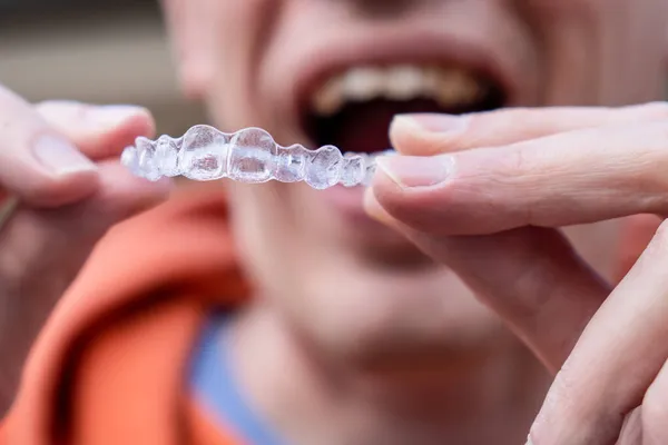 Man Holding Put Invisible Braces Orthodontic Dental Braces Teeth Straighteners — Stock Photo, Image