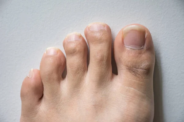 Voet Lange Nagel Tenen Witte Betonnen Achtergrond Lange Nagels Vuil — Stockfoto