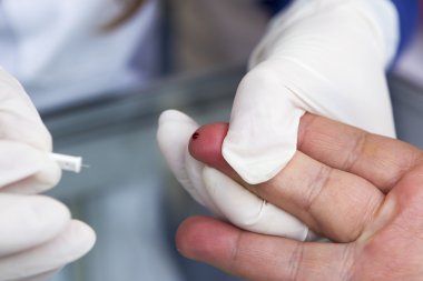 kan glikoz testi için