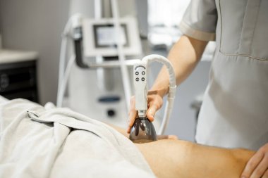 Applying vacuum roller massage on male leg using a special nozzle at beauty medical center, close-up. Concept of modern medical procedures for beauty