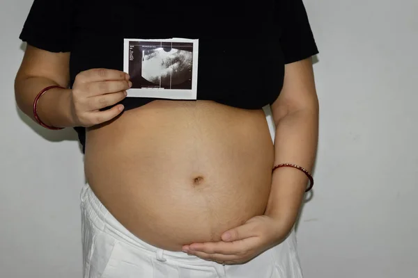 Mulheres Grávidas Jovens Mostrando Seu Sonograma Com Barriga Redonda Útero — Fotografia de Stock