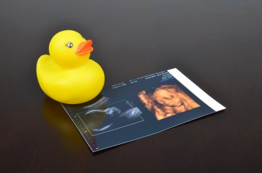 lastik ördek bebek oyuncak ultrason görüntüleri