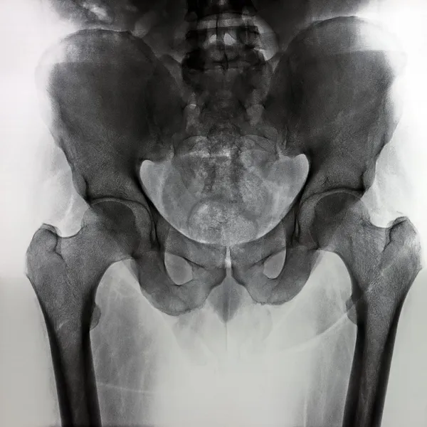 股関節痛写真素材、ロイヤリティフリー股関節痛画像Depositphotos®