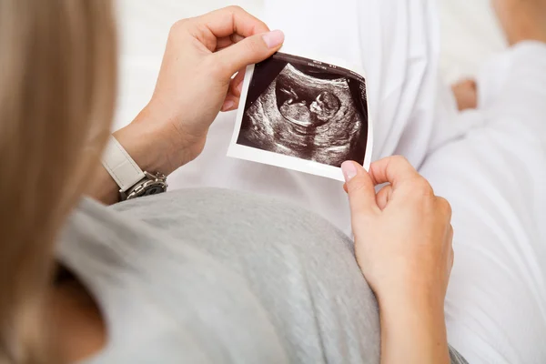 Zwangere vrouw kijkt naar echografie van de baby, close-up van de scan Stockafbeelding