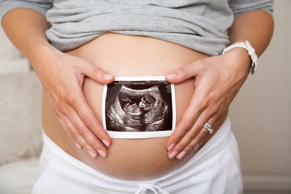 Close-up van zwangere vrouw met echografie scan op haar buik Stockfoto