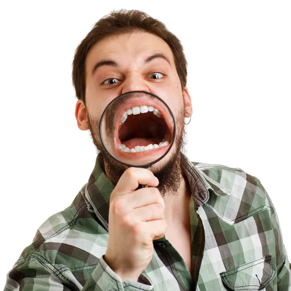 Mężczyzna krzyczy. Zobacz krzywe zęby przez szkło powiększające. — Zdjęcie stockowe