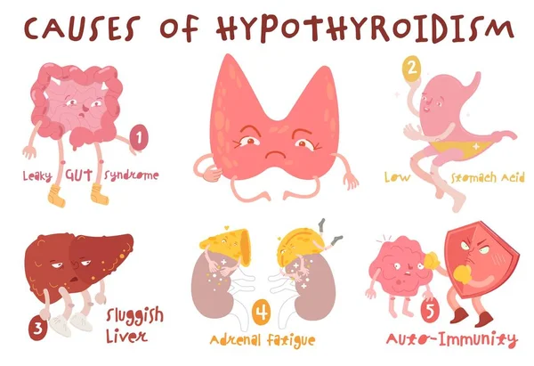 Causas de hipotiroidismo enfermedad de la glándula tiroides. Trastorno del sistema endocrino. Ilustración del vector médico en estilo de dibujos animados — Vector de stock