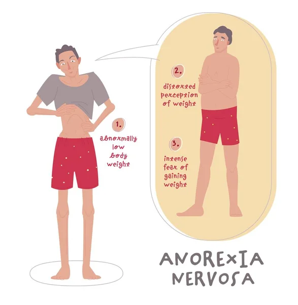 Eating Disorder Men Boys Anorexia Nervosa Medical Infographic Abnormal Eating — Stock vektor