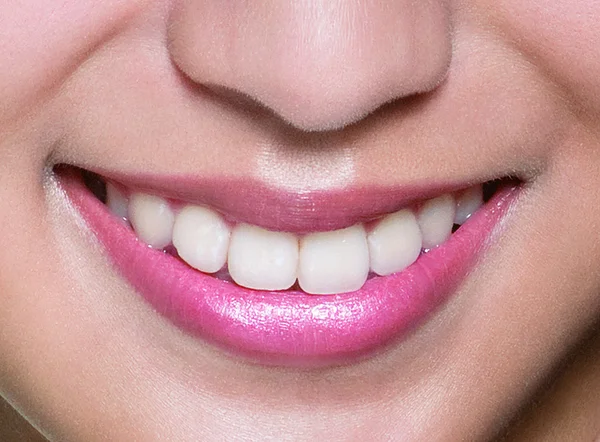 Vrouw glimlach. tanden whitening. tandheelkundige zorg. — Stockfoto