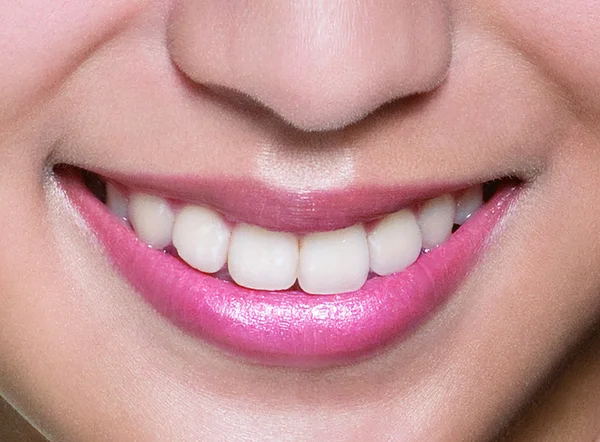 Sorriso feminino. Clareamento dos dentes. Cuidados dentários . — Fotografia de Stock