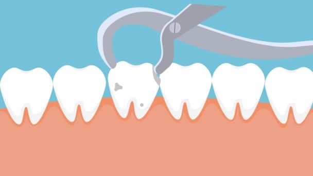 애니메이션에서 치아를 의사가 영상으로 치아를 치아를 애니메이션 — 비디오