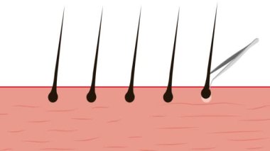 Cımbızla tüyleri çıkarma konseptinin 4K animasyonu. 4K 'lık vücut kıllarını çıkarmak için cımbız kullanıyor. El cımbızı ile güzellik salonu konsepti vücut kılları, animasyon video.