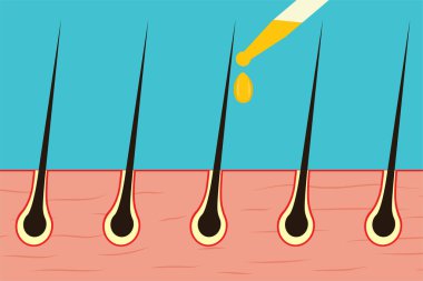 Saç büyütme konseptini oluşturmak için yağ kullanmak. Serum veya doğal yağ saçların uzamasına yardımcı olur. Saç yağını güzellik tedavisi ve güçlü saçlar için kullanıyor. Saç bakım dermatoloji tedavi yöntemi ve ilaç kullanımı.