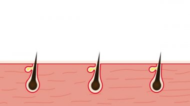 Lazer 4K animasyon kullanarak kökten vücut kılları alınıyor. Lazer tedavisiyle saç çıkarılıyor. 4K görüntüsü. Güzellik salonu bilgi toplar ve vücut kılları konseptini kaldırır..