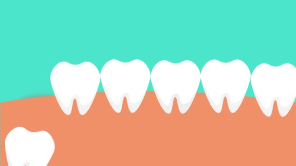 牙齿从里面推动 给牙龈4K动画带来痛苦 危险的智慧牙痛导致牙龈疼痛的镜头 智齿穿过牙龈发出红色疼痛信号动画 — 图库视频影像