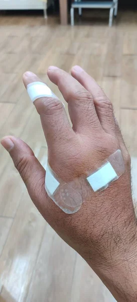 Hand injuries from animal bites