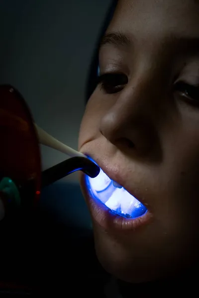Dentista Que Realiza Tratamiento Luz Ultravioleta Niño Concepto Cuidado Dental —  Fotos de Stock