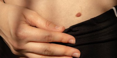 Cilt üzerindeki doğum lekeleri cilt üzerindeki çıplak güneş etkisinin detaylarını kapat. Doğum lekeleri Pigmentasyon ve bir sürü doğum lekesi olan ultraviyole radyasyon kadınının sağlık etkileri..