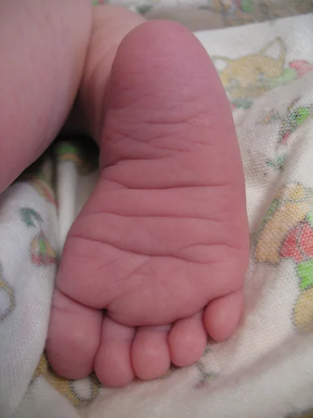 Leg of the baby — Stock Photo, Image