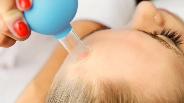Kosmetolog Gör Ansikte Vakuum Massage Med Kopp Kopp Professionell Kosmetisk — Stockfoto