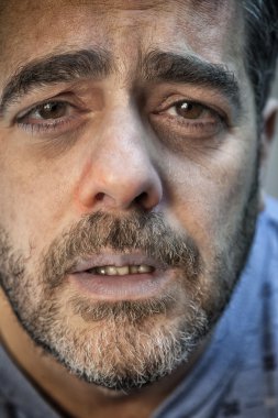 hasta bir adam Close-Up