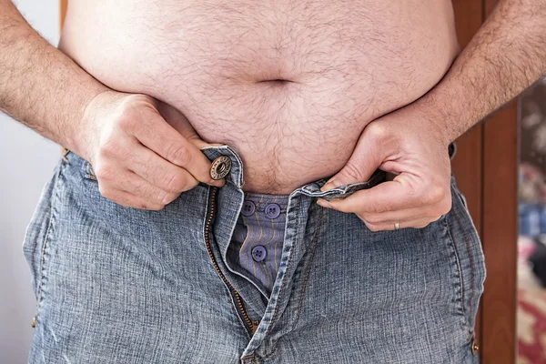 Übergewichtiger Mann versucht, zu kleine Kleidung zu befestigen — Stockfoto
