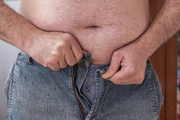 超重的人试图加快太小的衣服 — 图库照片