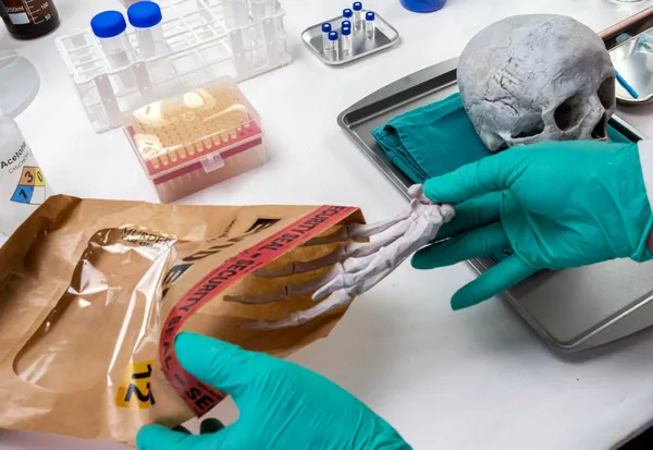 Forensiker Entfernt Rechte Hand Des Menschlichen Skeletts Aus Asservatensack Mord — Stockfoto