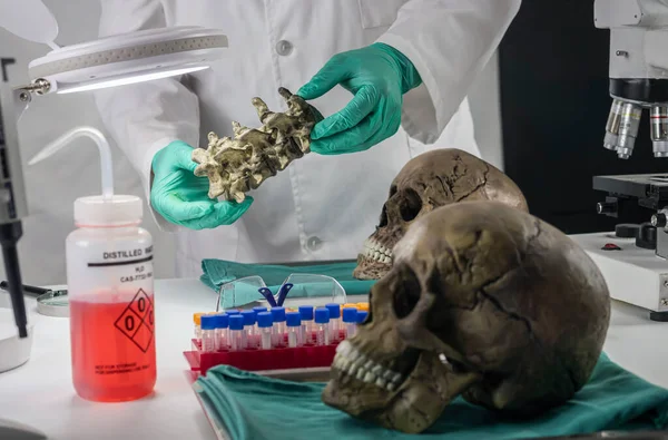 Forensic Scientist Examines Human Skull Extract Dna Forensic Laboratory Conceptual — Stockfoto