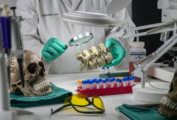 Forensic scientist examines human skull of adult male homocide victim to extract DNA, forensic laboratory, conceptual image