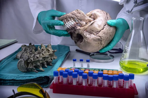 Forensic Scientist Examines Human Skull Adult Male Homocide Victim Extract — Stockfoto