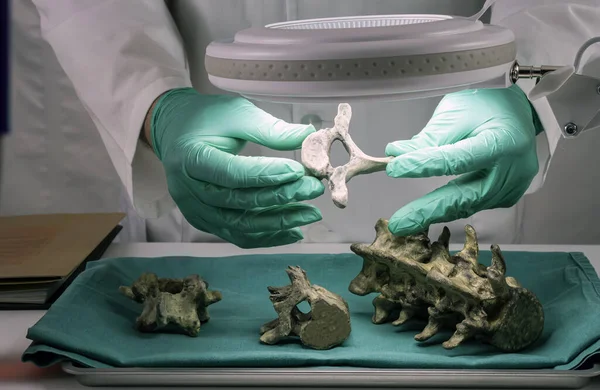 Forensic Scientist Examines Victim Vertebrae Extract Dna Forensic Lab Conceptual Imagen de archivo