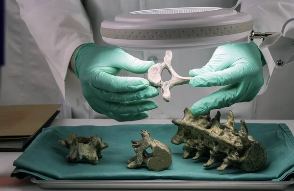 Forensic Scientist Examines Victim Vertebrae Extract Dna Forensic Lab Conceptual Rechtenvrije Stockfoto's